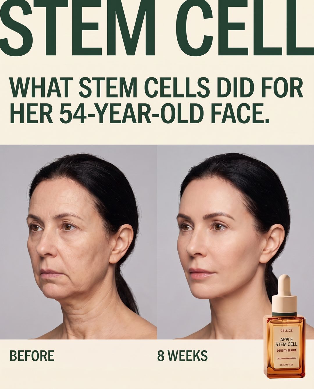 Cellics Stem Cell Renewal Serum result