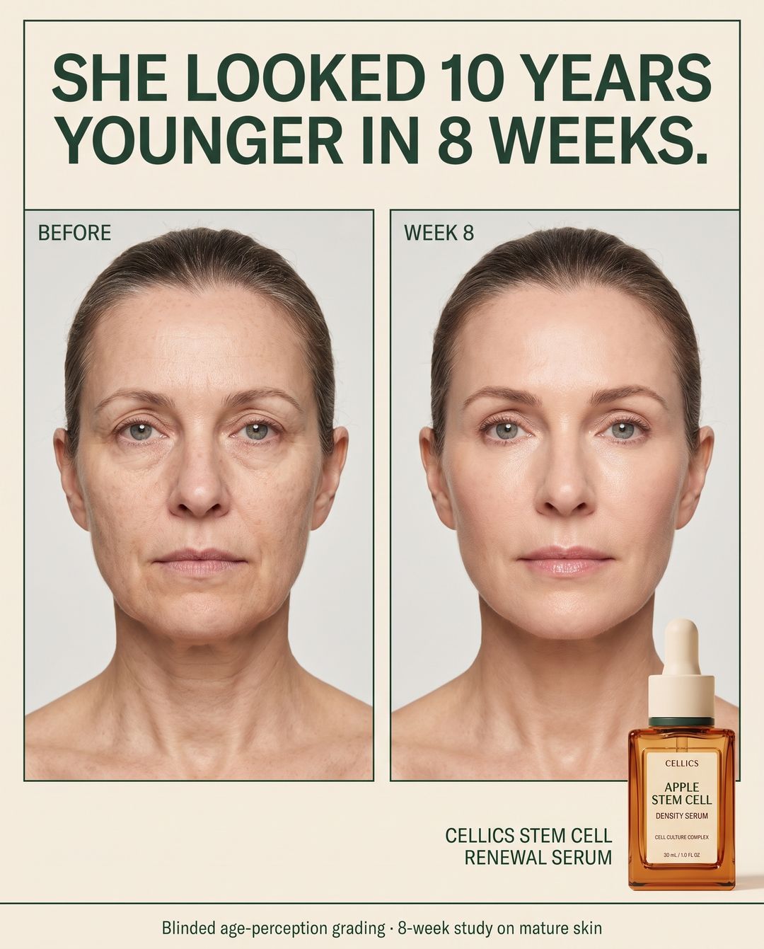 Before and after 8 weeks of Cellics Stem Cell Renewal Serum
