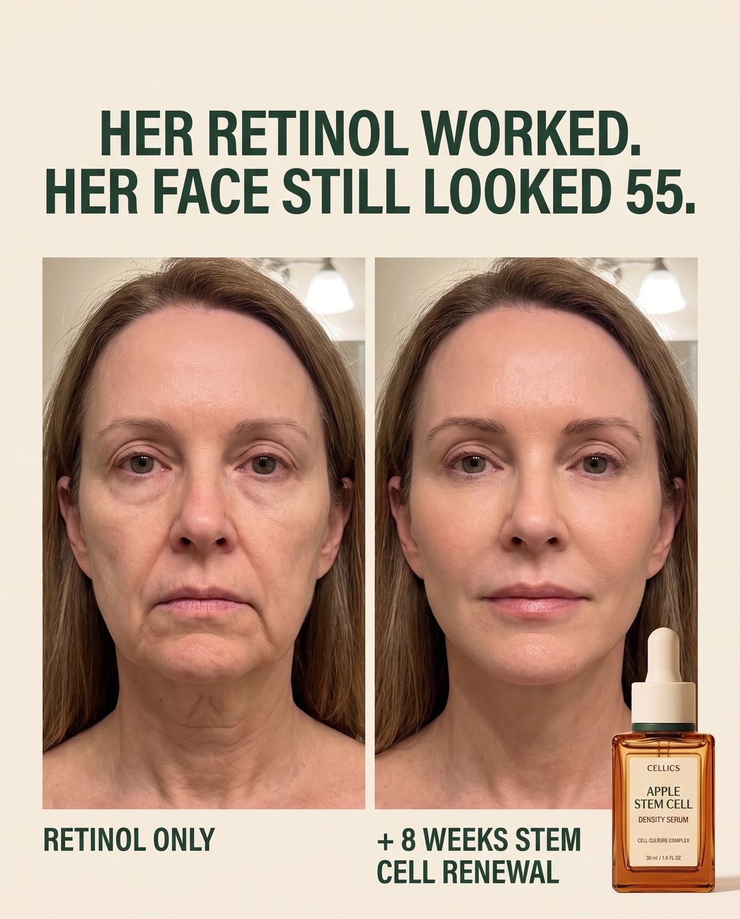 Cellics Stem Cell Renewal Serum result