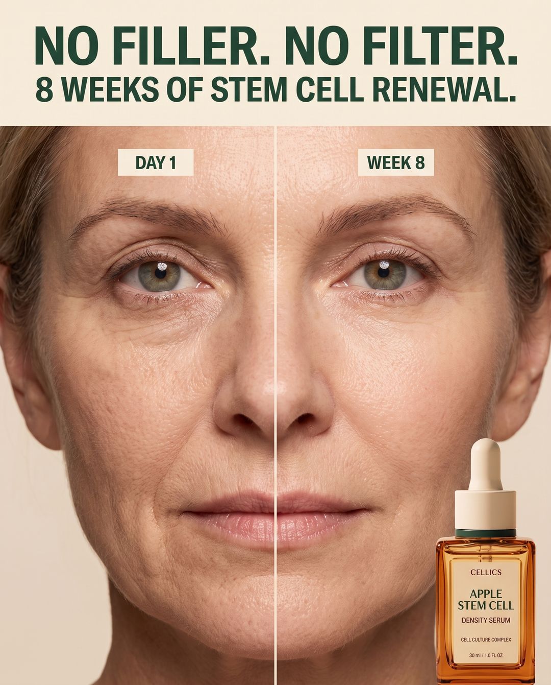 Cellics Stem Cell Renewal Serum result